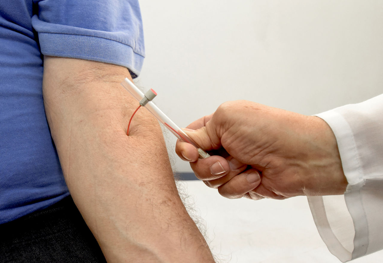 Na imagem há a mão de um profissional de saúde aplicando um teste com a ponta vermelha de hanseníase, no braço de um paciente de camiseta azul.