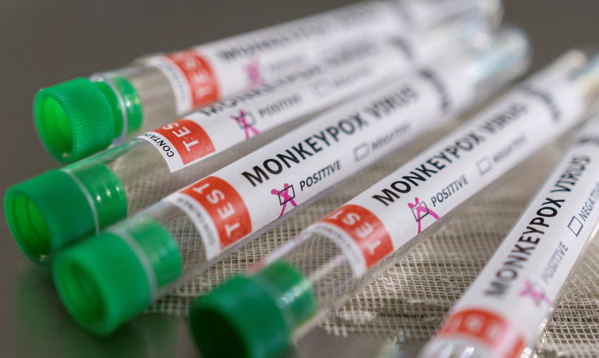 DESCRIÇÃO DE IMAGEM: foto de tubos de exames, transparentes, com tampas verdes e etiquetas brancas com a descrição 'monkeypox, positive'